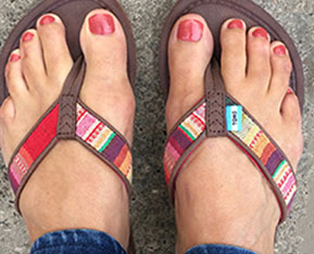 best sandals after bunion surgery