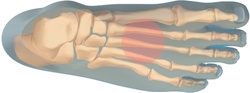 Metatarsals