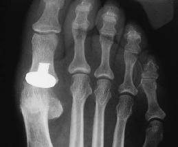 X-ray