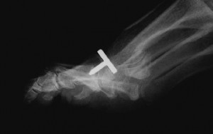 X-ray01