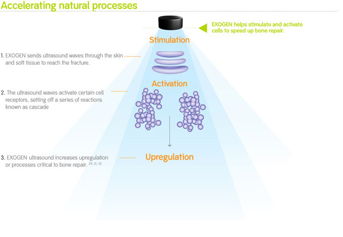 Bone Growth Stimulation: A Critical Analysis Review